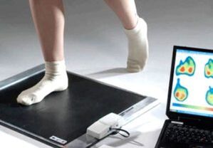 Diagnosis of hallux valgus