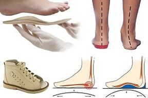 orthopedic shoes for hallux valgus in a child