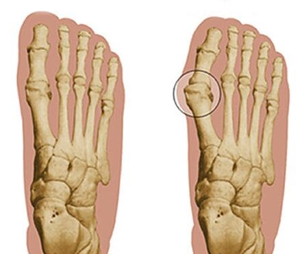 Foot development