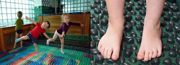 Gymnastics for Valgo deformation